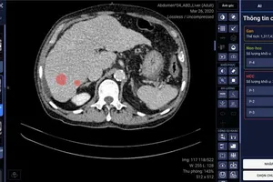 VinBrain cùng BV ĐH Y Dược TP.HCM phát hiện và chẩn đoán ung thư gan bằng AI