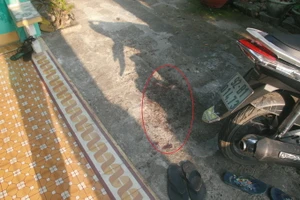 Bắn vào má người yêu rồi chở đi cấp cứu, xong... bỏ trốn 