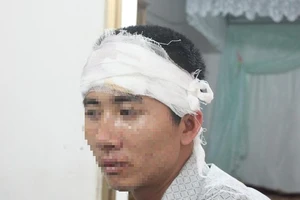 Một giám đốc bị truy sát tại bàn nhậu