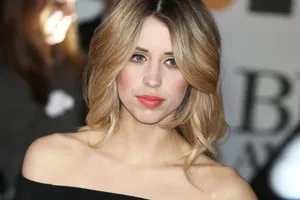 Người mẫu Anh qua đời ở tuổi 25