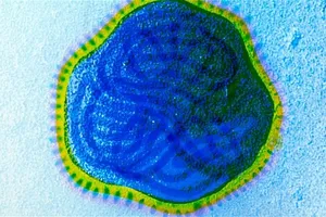 Trị ung thư bằng virus sởi