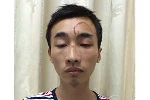 Gã trai chuyên rình phụ nữ tắm để trộm iPhone