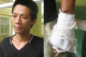 Ca sĩ phòng trà tạt axit vợ vì bị ‘cắm sừng’