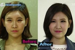 Truyền hình thực tế Hàn Quốc đề cập góc khác của phẫu thuật thẩm mỹ