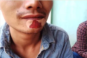 Đi ăn liên hoan đậu đại học, bị đánh tới tấp