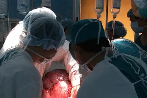 Cắt khối bướu tử cung nặng 26 kg