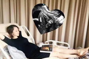 Từ Nhược Tuyên công khai ảnh siêu âm mang bầu bé trai