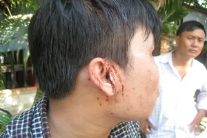 Clip công an dựng lại hiện trường vụ hai phóng viên bị hành hung