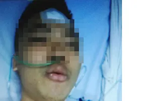 Va quẹt giao thông, nam thanh niên bị đâm thấu tim