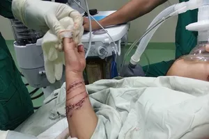 Bé trai bốn tuổi bị cá sấu cắn nát tay