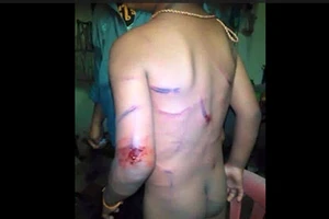 Bé 7 tuổi bị cha dượng đánh dã man là tin 'vịt'