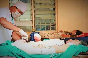 Bình phân bón phát nổ, thiếu niên bị cắt cụt 2 bàn tay