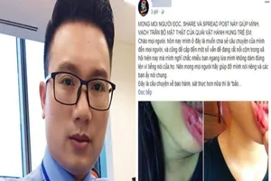 Toàn cảnh vụ MC Minh Tiệp bị tố bạo hành em vợ suốt 5 năm