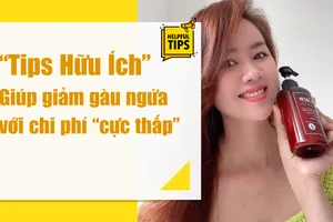 Hé lộ tips hữu ích, giá rẻ để trị gàu ngứa vào mùa lạnh