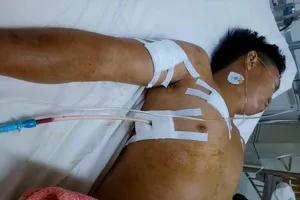 Bị đâm gục vì không chở đi tìm người