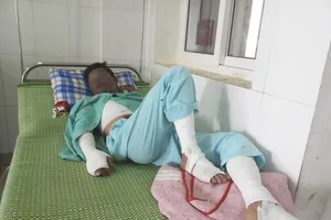 Nổ điện thoại, game thủ bị nước sôi dội vào người