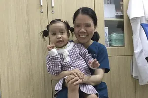 Khối u quái hỗn hợp vùng mặt bé gái 4 tuổi