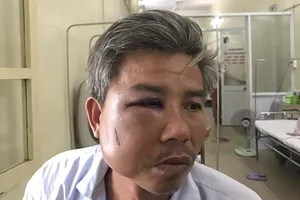 Nhân viên Trung tâm công viên cây xanh bị đánh nhập viện