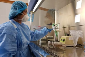 Thừa Thiên- Huế mua 10.000 test xét nghiệm nhanh