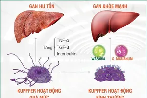 Tế bào Kupffer: “Kẻ hủy hoại giấu mặt” của gan