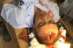 Bảo vệ nhân viên y tế, nhìn từ góc độ pháp lý 