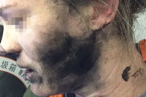 Cháy nổ thiết bị công nghệ hiểm họa cần được cảnh báo 