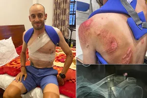 Nhiều đồng nghiệp cảm kích, chia sẻ với tai nạn của Javier