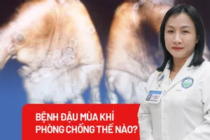 Xuất hiện ca đậu mùa khỉ, bác sĩ khuyến cáo gì?