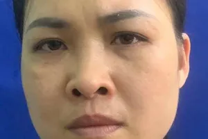 Khởi tố 1 phụ nữ nhờ người ép tình xưa trả nợ