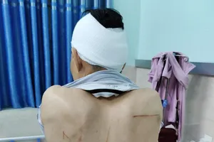 Hải Phòng: Truy bắt nhóm dùng dao, kiếm chém người trọng thương ở cổng bệnh viện 