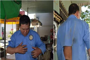 Bảo vệ công trường bị nhóm người lạ dùng gậy sắt đánh