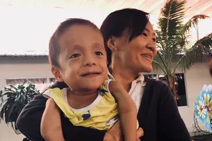 “Có bé chỉ nằm một chỗ hắt xì cũng gãy xương…”