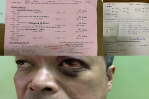 Đánh hàng xóm vì cái dây phơi đồ ở chung cư