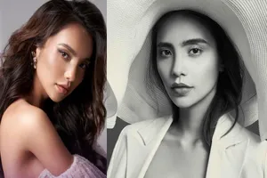 Cô gái từng khâu 7 mũi trên trán thi Hoa hậu Hoàn vũ Việt Nam 2021