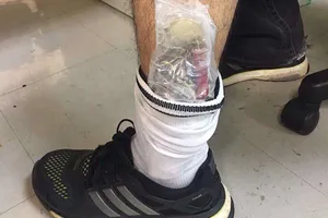 Nhiều đồng hồ trong ống quần của khách xuống sân bay