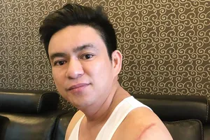 Điều tra nhóm chém bác sĩ ở phố đi bộ