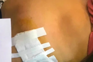 Người phụ nữ tổ chức đường dây mua bán nội tạng xuyên quốc gia