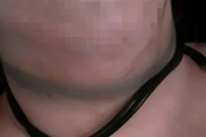 Thiếu niên 15 tuổi siết cổ tài xế taxi để cướp ở quận 2