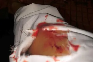 Công an làm việc với cô gái bị rạch tay ở Thủ Đức