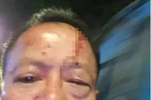 Một Việt kiều bị đánh hội đồng ở quận 10, TP.HCM