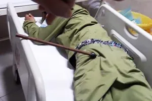 Bị kẻ nghi là trộm chó, chích điện ở Củ Chi