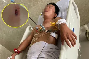 Củ Chi: Mâu thuẫn tiền bạc, rút súng bắn con nợ