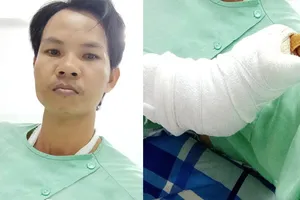 Công an, bảo vệ dân phố ở quận 8 bị chém khi làm nhiệm vụ