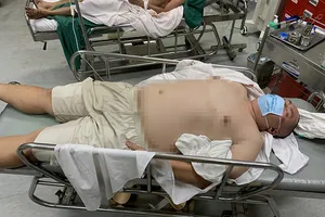 Người đi bộ bị xe máy tông trọng thương ở Bình Thạnh