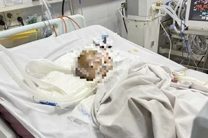 Đang tích cực điều trị cho bé 14 tháng tuổi bị bảo mẫu bạo hành