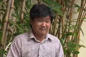 Người đàn ông lén vợ mua tóc giả vì căn bệnh hói đầu