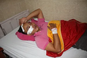 Bắt giữ nghi can dùng búa đập đầu tài xế cướp tài sản