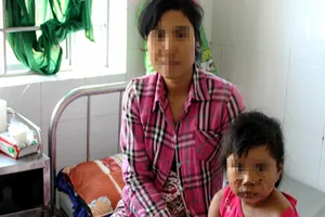 Anh trai nhóm lửa bằng xăng làm em gái bỏng nặng