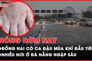 Nóng hôm nay: Phát hiện ca bệnh đậu mùa khỉ đầu tiên tại Đồng Nai