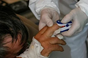 Nhân viên y tế đang đo nồng độ oxy của một bệnh nhân nhiễm COVID-19 tại một bệnh viện ở thị trấn Ovruch, Ukraine ngày 10-11.